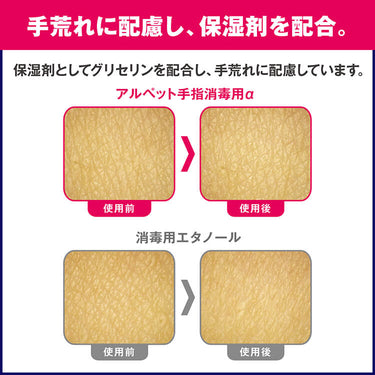 サラヤ 41231 アルペット手指消毒用α 1L