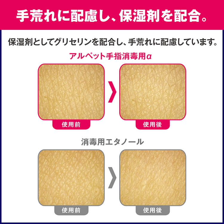 サラヤ 41231 アルペット手指消毒用α 1L